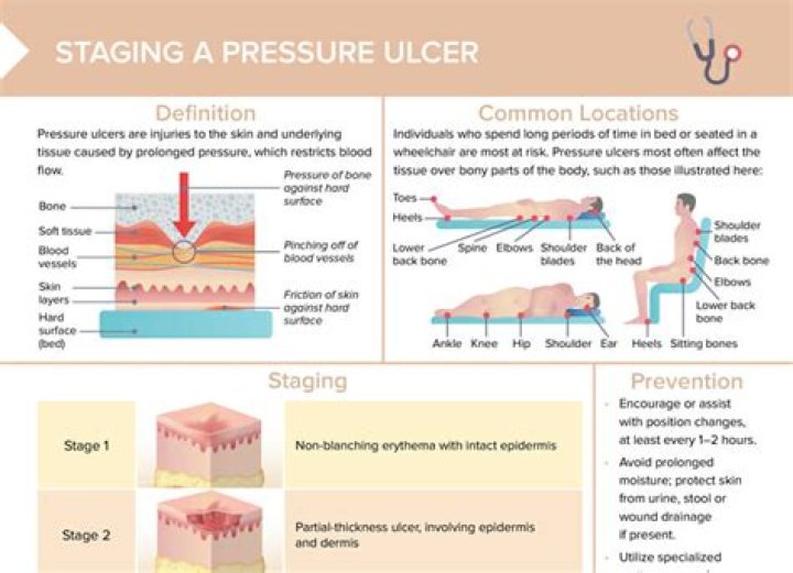 Do ulcers hurt when you move?