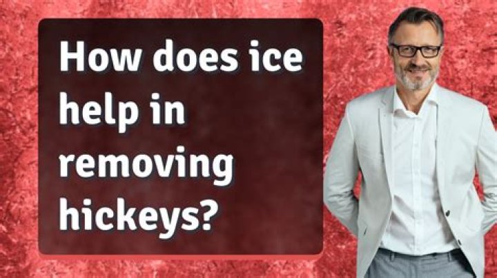 Does ice help hickeys?