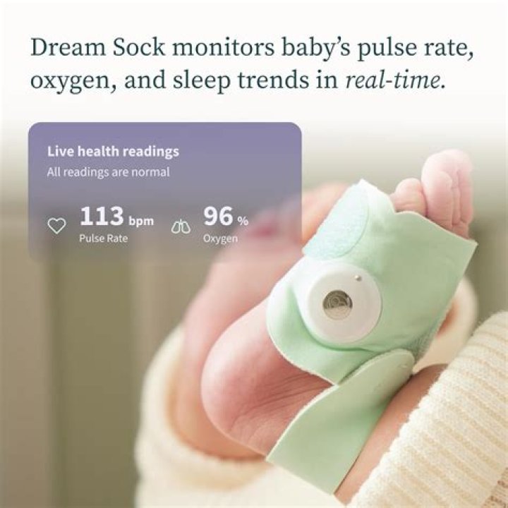Does the owlet dream sock alert you?
