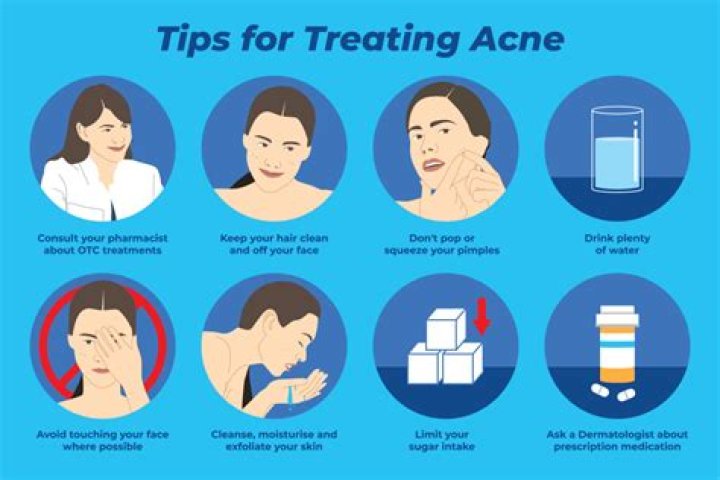 How can I clear up my acne?