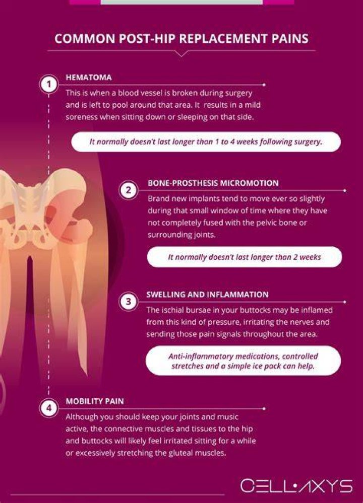 How Long Will my leg be swollen after hip replacement?