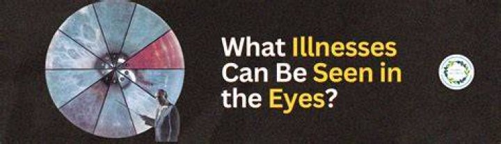 What illnesses can be seen in the eyes?