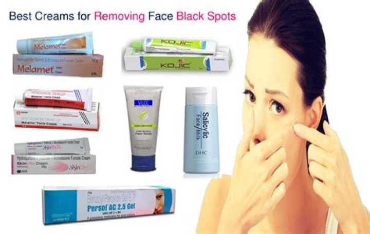 Which cream is best to remove blackheads?